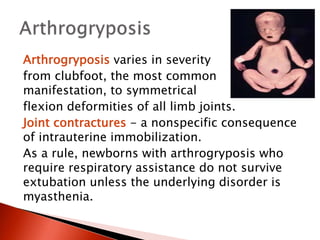 Arthrogryposis varies in severity
from clubfoot, the most common
manifestation, to symmetrical
flexion deformities of all limb joints.
Joint contractures - a nonspecific consequence
of intrauterine immobilization.
As a rule, newborns with arthrogryposis who
require respiratory assistance do not survive
extubation unless the underlying disorder is
myasthenia.
 
