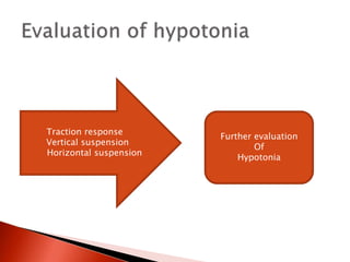 Traction response
Vertical suspension
Horizontal suspension
Further evaluation
Of
Hypotonia
 