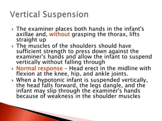  The examiner places both hands in the infant's
axillae and, without grasping the thorax, lifts
straight up
 The muscles of the shoulders should have
sufficient strength to press down against the
examiner's hands and allow the infant to suspend
vertically without falling through
 Normal response – Head erect in the midline with
flexion at the knee, hip, and ankle joints.
 When a hypotonic infant is suspended vertically,
the head falls forward, the legs dangle, and the
infant may slip through the examiner's hands
because of weakness in the shoulder muscles
 