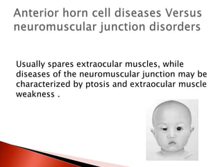 Usually spares extraocular muscles, while
diseases of the neuromuscular junction may be
characterized by ptosis and extraocular muscle
weakness .
 