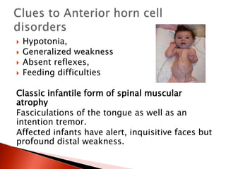  Hypotonia,
 Generalized weakness
 Absent reflexes,
 Feeding difficulties
Classic infantile form of spinal muscular
atrophy
Fasciculations of the tongue as well as an
intention tremor.
Affected infants have alert, inquisitive faces but
profound distal weakness.
 