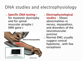  Specific DNA testing -
for myotonic dystrophy
and for spinal
muscular atrophy (
SMN gene )
 Electrophysiological
studies - Shows
abnormalities in
nerves, myopathies,
and disorders of the
neuromuscular
junction
 Normal EMG usually
suggest central
hypotonia , with few
exceptions
 