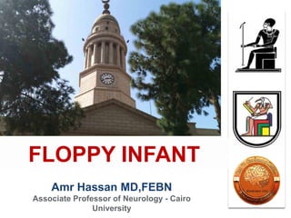 Amr Hassan MD,FEBN
Associate Professor of Neurology - Cairo
University
FLOPPY INFANT
 