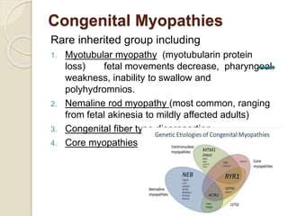 Congenital Myopathies
Rare inherited group including
1. Myotubular myopathy (myotubularin protein
loss) fetal movements decrease, pharyngeal
weakness, inability to swallow and
polyhydromnios.
2. Nemaline rod myopathy (most common, ranging
from fetal akinesia to mildly affected adults)
3. Congenital fiber type disproportion
4. Core myopathies
 