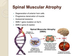 Spinal Muscular Atrophy
 Degeneration of anterior horn cells
 Progressive denervation of muscle
 Autosomal recessive
 SMN 1 gene mutation on 5q13.
 SMN 2 gene (5 copies)
 