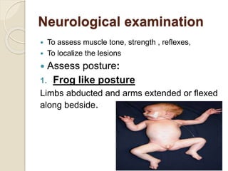 Neurological examination
 To assess muscle tone, strength , reflexes,
 To localize the lesions
 Assess posture:
1. Frog like posture
Limbs abducted and arms extended or flexed
along bedside.
 