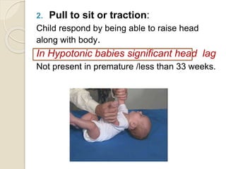 2. Pull to sit or traction:
Child respond by being able to raise head
along with body.
In Hypotonic babies significant head lag
Not present in premature /less than 33 weeks.
 