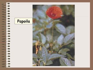 Papoila 