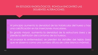EN ESTUDIOS RADIOLÓGICOS, ROHOLM ENCONTRÓ LAS 
SIGUIENTES ALTERACIONES: 
1. Al principio aumenta la densidad de las trabéculas del hueso y hay 
una calcificación en las inserciones musculares. 
2. En grado mayor, aumenta la densidad de la estructura ósea y se 
pierde la definición del contorno de los huesos. 
3. Al avanzar la enfermedad, se pierden los detalles del tejido óseo 
que se observa como una sombra difusa de color blanco mármol. 
Flúor 11 
 