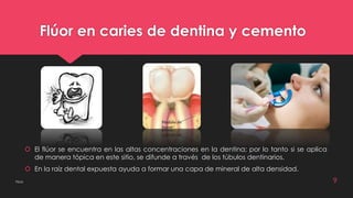 Flúor en caries de dentina y cemento 
 El flúor se encuentra en las altas concentraciones en la dentina; por lo tanto si se aplica 
de manera tópica en este sitio, se difunde a través de los túbulos dentinarios. 
 En la raíz dental expuesta ayuda a formar una capa de mineral de alta densidad. 
Flúor 9 
 