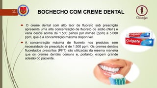 BOCHECHO COM CREME DENTAL
 O creme dental com alto teor de fluoreto sob prescrição
apresenta uma alta concentração de fluoreto de sódio (NaF) e
varia desde acima de 1.500 partes por milhão (ppm) a 5.000
ppm, que é a concentração máxima disponível.
 A concentração máxima de fluoreto nos produtos sem
necessidade de prescrição é de 1.500 ppm. Os cremes dentais
fluoretados prescritos (PFT) são utilizadas da mesma maneira
que os cremes dentais comuns e, portanto, exigem grande
adesão do paciente.
11
 