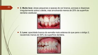  2. Muito leve: áreas pequenas e opacas de cor branca, porosas e dispersas
irregularmente sobre o dente, mas envolvendo menos de 25% da superfície
dentária vestibular.
 3. Leve: opacidade branca do esmalte mais extensa do que para o código 2,
recobrindo menos de 50% da superfície dentária.
20
 
