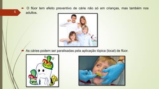 O flúor tem efeito preventivo de cárie não só em crianças, mas também nos
adultos.
 As cáries podem ser paralisadas pela aplicação tópica (local) de flúor.
6
 