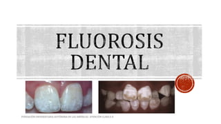 FUNDACIÓN UNIVERSITARIA AUTÓNOMA DE LAS AMÉRICAS- ATENCIÓN CLINICA II 
 