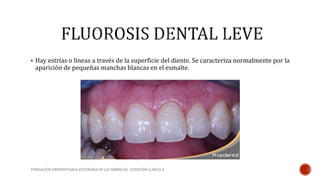  Hay estrías o líneas a través de la superficie del diente. Se caracteriza normalmente por la 
aparición de pequeñas manchas blancas en el esmalte. 
FUNDACIÓN UNIVERSITARIA AUTÓNOMA DE LAS AMÉRICAS- ATENCIÓN CLINICA II 
 