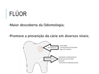 •Maior descoberta da Odontologia;
•Promove a prevenção da cárie em diversos níveis;
FLÚOR
 