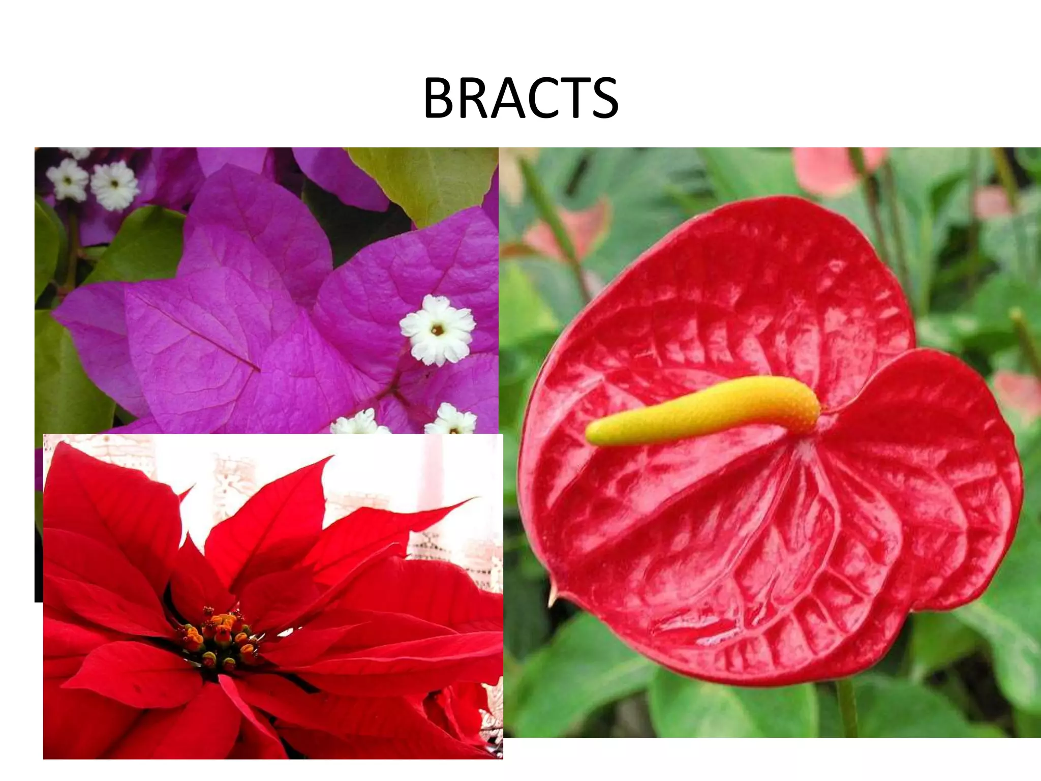 BRACTS