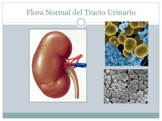 Flora Normal del Tracto Urinario
 