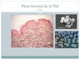 Flora Normal de la Piel
 