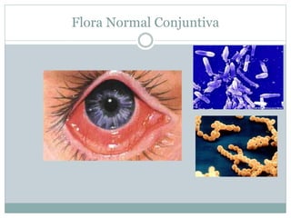 Flora Normal Conjuntiva
 