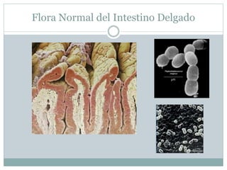 Flora Normal del Intestino Delgado
 