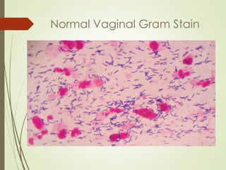 Normal Vaginal Gram Stain
 