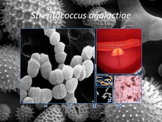 Streptococcus agalactiae
 