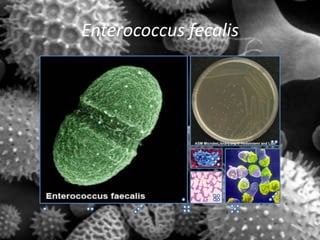 Enterococcus fecalis
 
