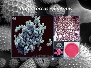 Stafilococcus epidermis
 