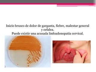 Inicio brusco de dolor de garganta, fiebre, malestar general
                         y cefalea.
    Puede existir una acusada linfoadenopatía cervical.
 