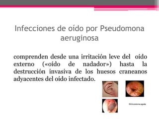 Infecciones de oído por Pseudomona
             aeruginosa

comprenden desde una irritación leve del oído
externo («oído de nadador») hasta la
destrucción invasiva de los huesos craneanos
adyacentes del oído infectado.
 