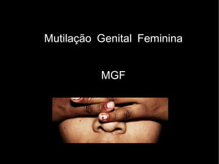 Mutilação Genital Feminina


          MGF
 