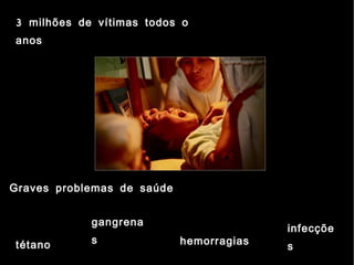 3 milhões de vítimas todos o
anos




Graves problemas de saúde


            gangrena
                                          infecçõe
tétano      s               hemorragias   s
 