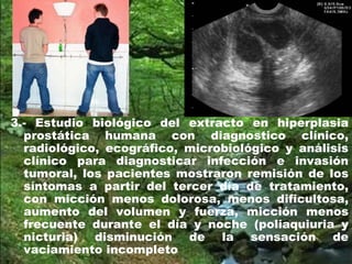 3.- Estudio biológico del extracto en hiperplasia
prostática humana con diagnostico clínico,
radiológico, ecográfico, microbiológico y análisis
clínico para diagnosticar infección e invasión
tumoral, los pacientes mostraron remisión de los
síntomas a partir del tercer día de tratamiento,
con micción menos dolorosa, menos dificultosa,
aumento del volumen y fuerza, micción menos
frecuente durante el día y noche (poliaquiuria y
nicturia) disminución de la sensación de
vaciamiento incompleto
 