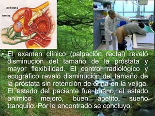 • El examen clínico (palpación rectal) reveló
disminución del tamaño de la próstata y
mayor flexibilidad. El control radiológico y
ecográfico reveló disminución del tamaño de
la próstata sin retención de orina en la vejiga.
El estado del paciente fue bueno, el estado
anímico mejoro, buen apetito, sueño
tranquilo. Por lo encontrado se concluyo:
 