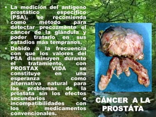 • La medición del antígeno
prostático especifico
(PSA), se recomienda
como método para
detectar precozmente el
cáncer de la glándula y
poder tratarlo en sus
estadios más tempranos.
• Debido a la frecuencia
con que los valores del
PSA disminuyen durante
el tratamiento, con
PROSTAX VIDA se
constituye en una
esperanza como
alternativa natural para
los problemas de la
próstata sin los efectos
secundarios e
incompatibilidades con
los medicamentos
convencionales.
CÁNCER A LA
PROSTÁTA
 
