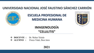 ESCUELA PROFESIONAL DE
MEDICINA HUMANA
 DOCENTE : Dr. Walter Toledo
 ALUMNO : Flores Vidal, Jhon Jairo
2021
 