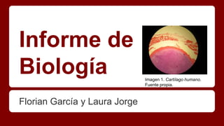 Informe de
Biología
Florian García y Laura Jorge
Imagen 1. Cartílago humano.
Fuente propia.
 