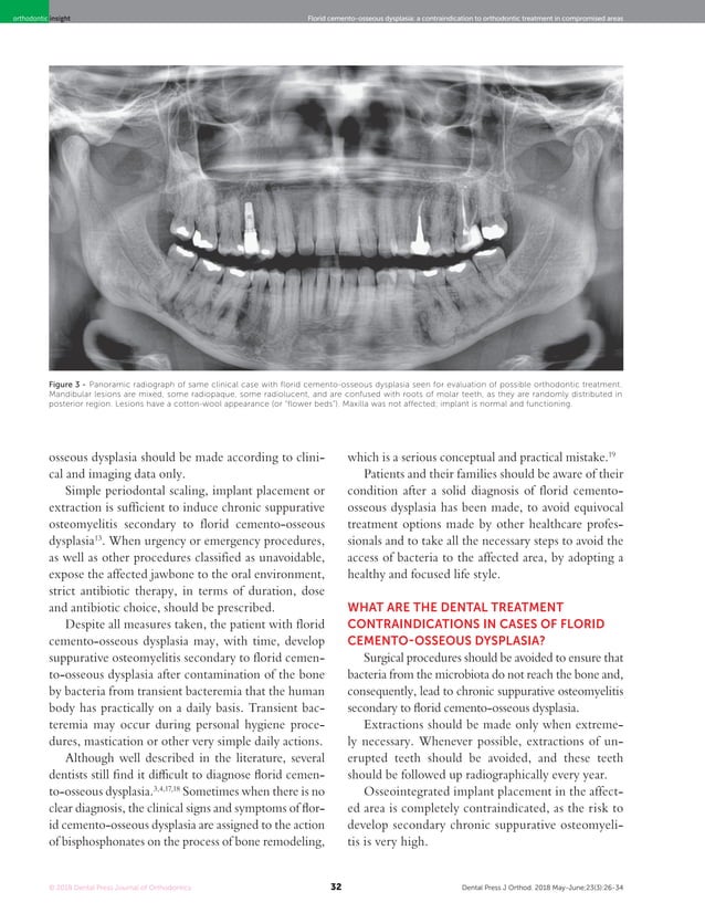 Florid cemento osseous dysplasia a contraind to ortho tx in compromised