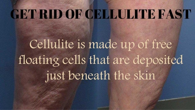 How To Get Rid Of Cellulite Fast