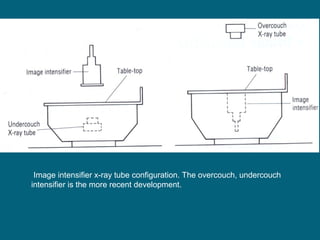 Image intensifier x-ray tube configuration. The overcouch, undercouch
intensifier is the more recent development.

 