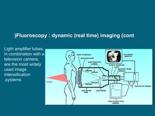)Fluoroscopy : dynamic (real time) imaging (cont
Light amplifier tubes,
in combination with a
television camera,
are the most widely
used image
intensification
.systems

 