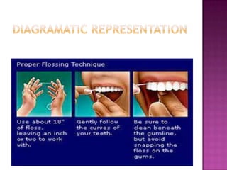 Flossing | PPTX