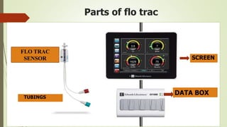 Parts of flo trac
SCREEN
DATA BOX
FLO TRAC
SENSOR
TUBINGS
 