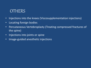 OTHERS 
• Injections into the knees (Viscosupplementation injections) 
• Locating foreign bodies 
• Percutaneous Vertebroplasty (Treating compressed fractures of 
the spine) 
• Injections into joints or spine 
• Image-guided anesthetic injections 
 