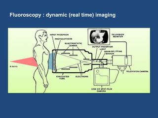 Fluoroscopy : dynamic (real time) imaging 
 