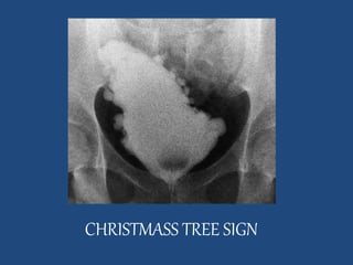 CHRISTMASS TREE SIGN 
 