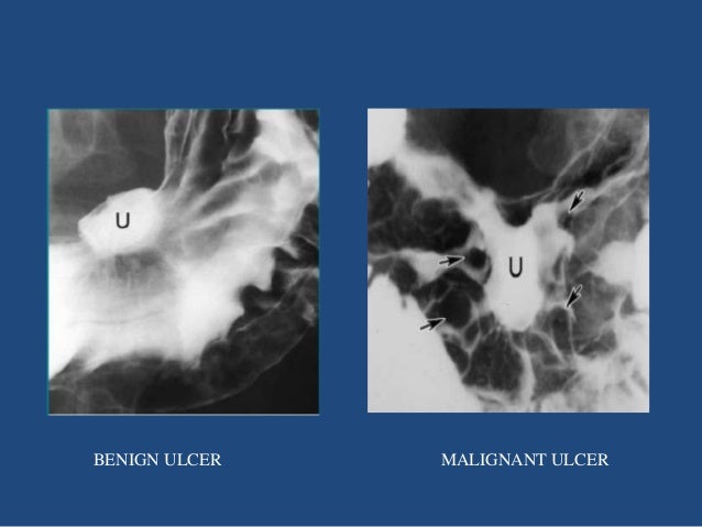 Flouroscopic procedures