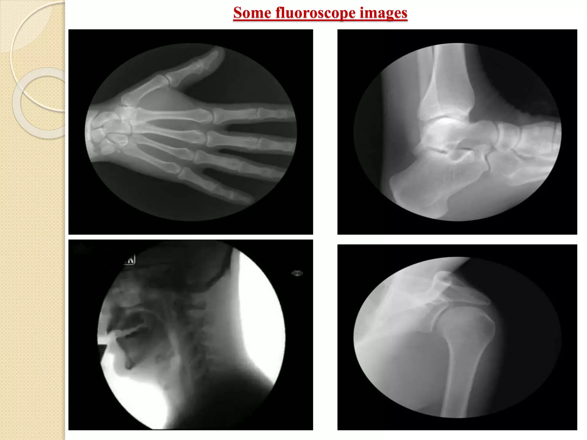 Some fluoroscope images
 
