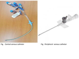 Fig. Central venous catheter Fig . Peripheral venous catheter
 